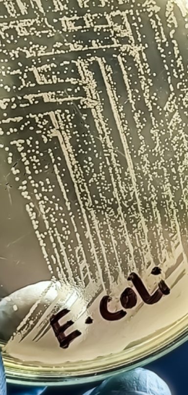 How is a common bacterium transforming plastic waste into life-saving medicines?