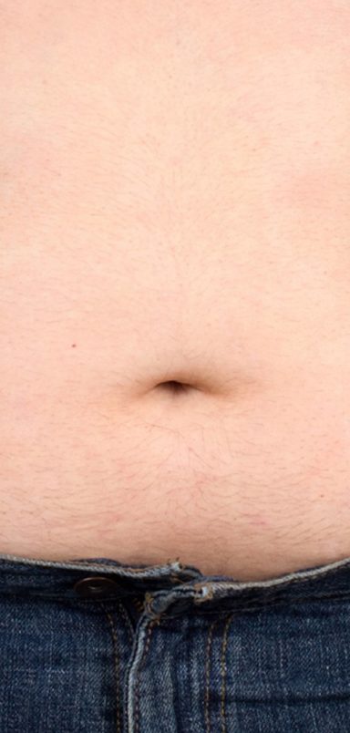 Doctor suggests 3 drinks for fatty liver health