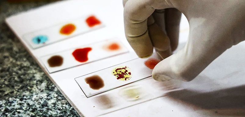 Why ‘Golden Blood’ is considered the world’s rarest blood type with only 1 in 6 million carriers