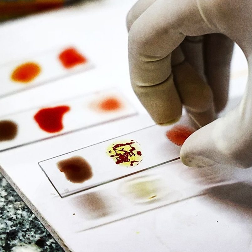 Why ‘Golden Blood’ is considered the world’s rarest blood type with only 1 in 6 million carriers