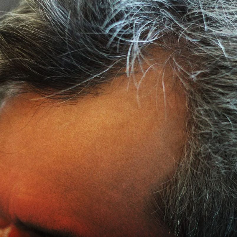 Why more people in their 20s are getting grey hair early and what causes it