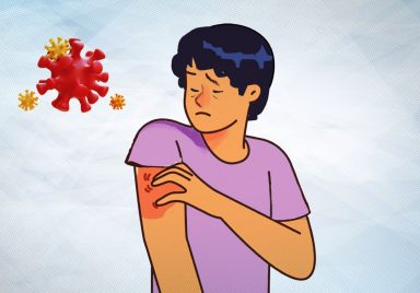 Why are skin diseases rising rapidly across Bangladesh right now?