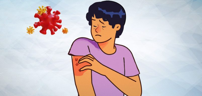 Why are skin diseases rising rapidly across Bangladesh right now?