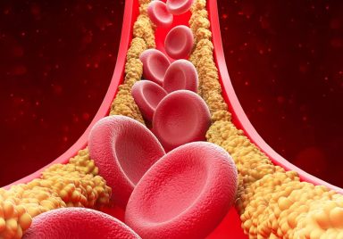 Why do cholesterol levels rise in winter?