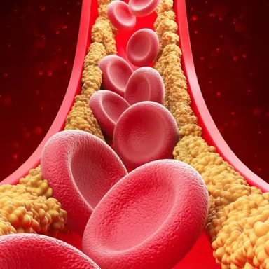 Why do cholesterol levels rise in winter?