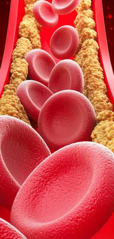 Why do cholesterol levels rise in winter?