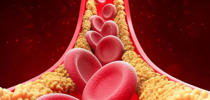 Why do cholesterol levels rise in winter?