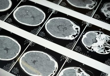 What goes on in the brain of a dying person?