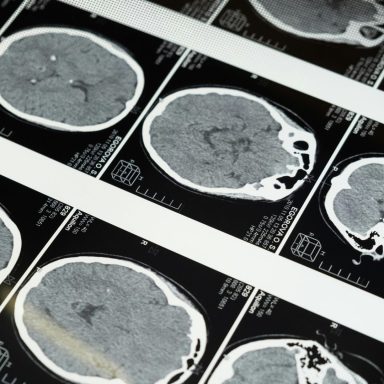 What goes on in the brain of a dying person?