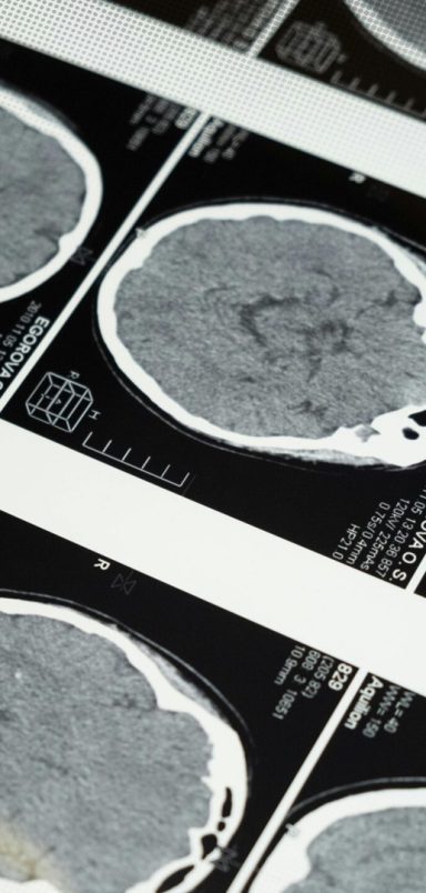 What goes on in the brain of a dying person?