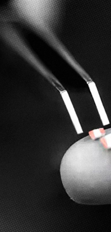 The 'bizarre' story of the world's first LSD trip