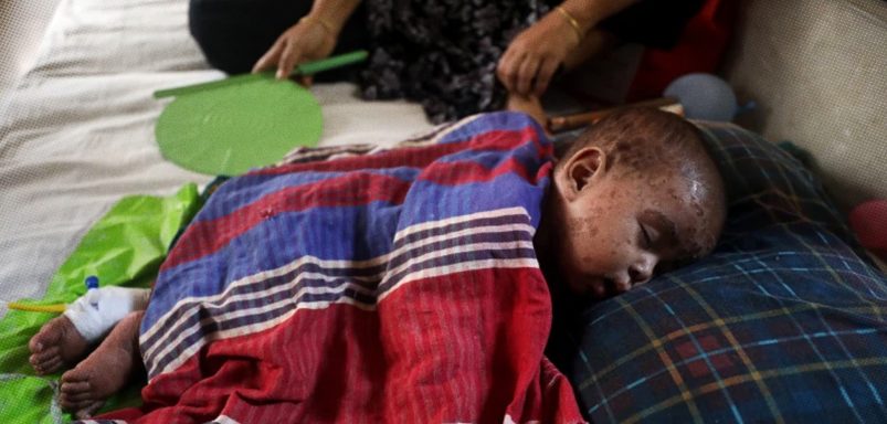 Which are the 30 high-risk areas for Bangladesh’s measles vaccination drive