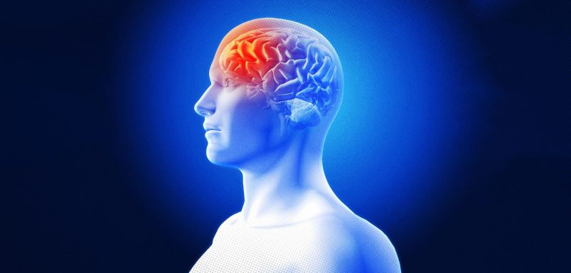 10 things you should know about migraines and how to manage them