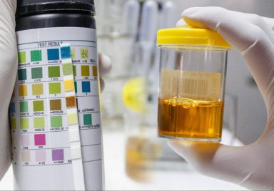 What does the color of your urine tell you about your body?