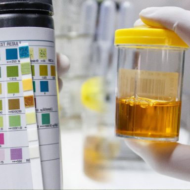 What does the color of your urine tell you about your body?