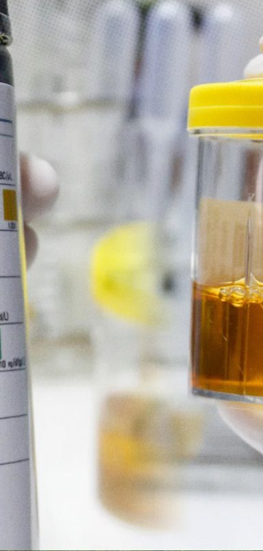 What does the color of your urine tell you about your body?