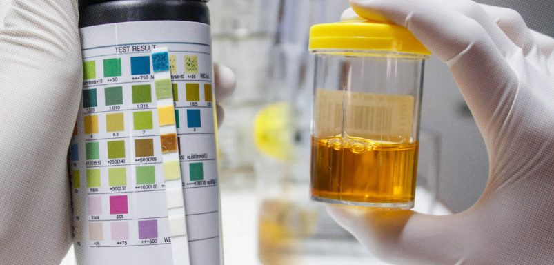 What does the color of your urine tell you about your body?