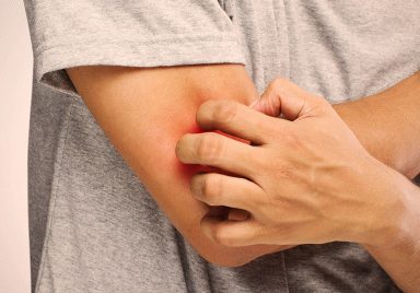 How to control your allergy during Eid?