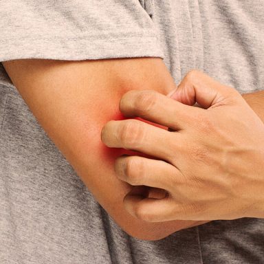 How to control your allergy during Eid?