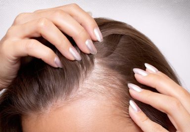 Can you slow down hair loss before it gets worse?