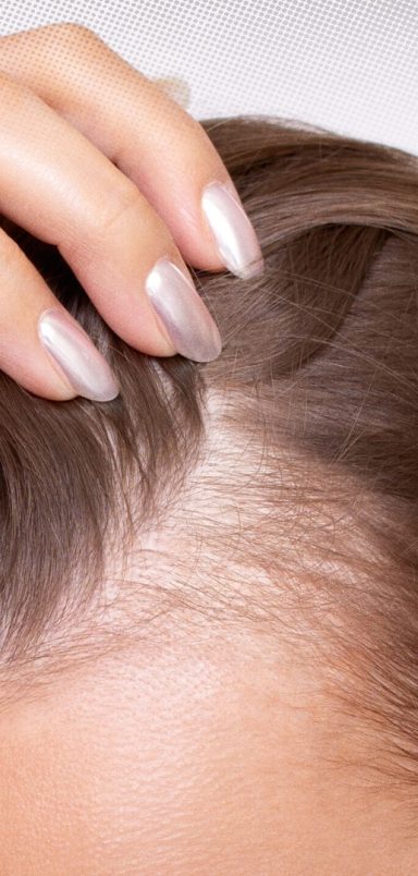 Can you slow down hair loss before it gets worse?
