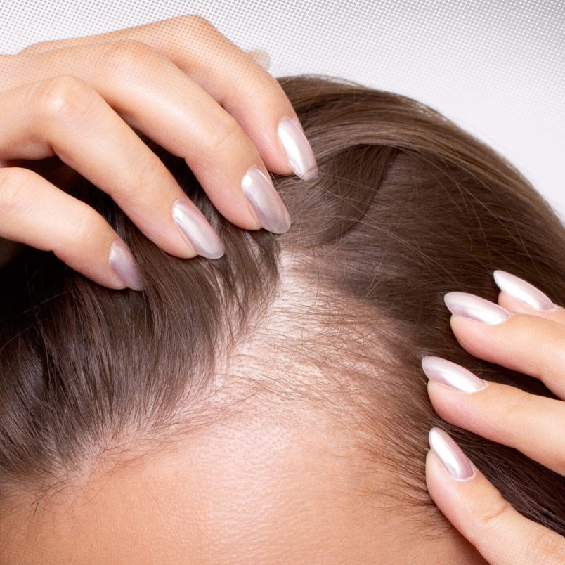 Can you slow down hair loss before it gets worse?