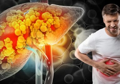 What causes fatty liver disease and how can you prevent it?