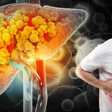 What causes fatty liver disease and how can you prevent it?