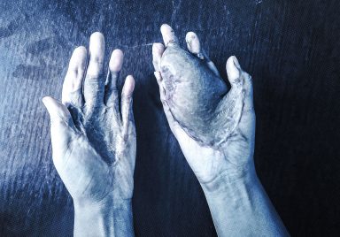 How fake spiritual healers are exploiting women and costing girls their hands