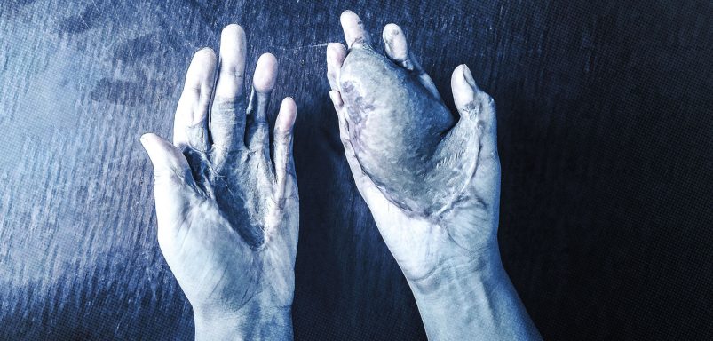 How fake spiritual healers are exploiting women and costing girls their hands