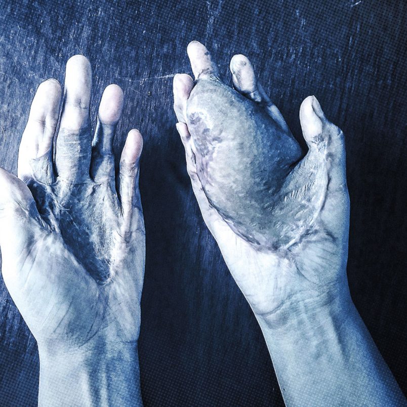 How fake spiritual healers are exploiting women and costing girls their hands