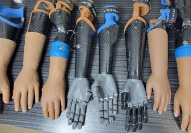 How Joy Barua's bionic hand is changing people's lives
