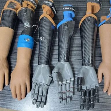 How Joy Barua's bionic hand is changing people's lives