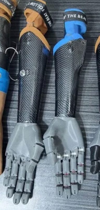 How Joy Barua's bionic hand is changing people's lives