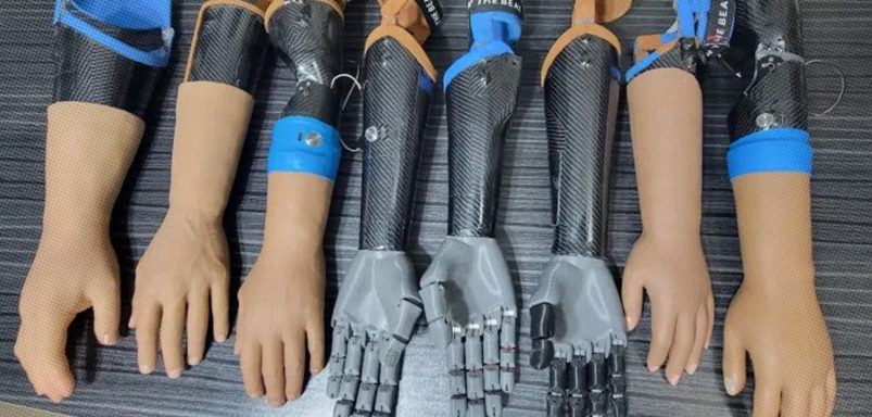 How Joy Barua's bionic hand is changing people's lives