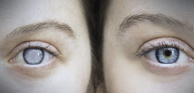 Why people can become blind without any warning signs