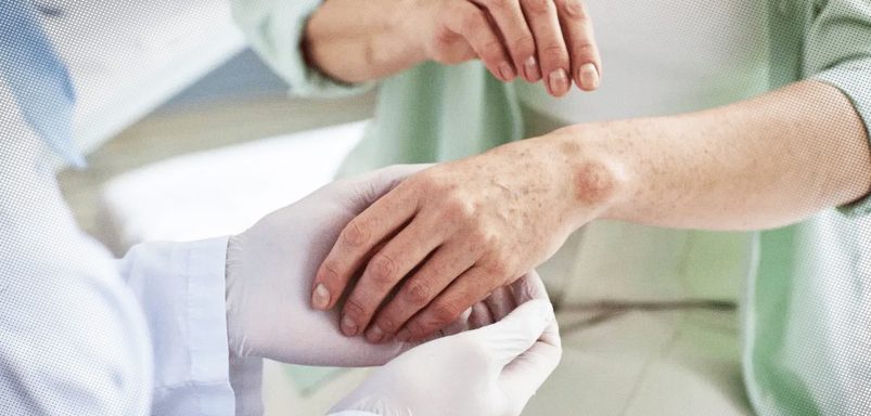 Which doctor to see for which common symptoms