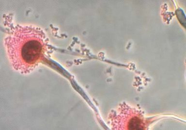 Why could this common Fungus become the world's next big health threat?