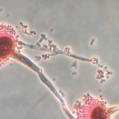 Why could this common Fungus become the world's next big health threat?