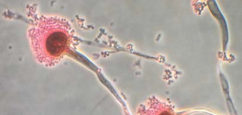 Why could this common Fungus become the world's next big health threat?