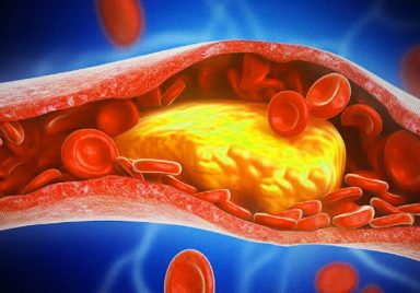 4 foods that raise your cholesterol and harm your heart