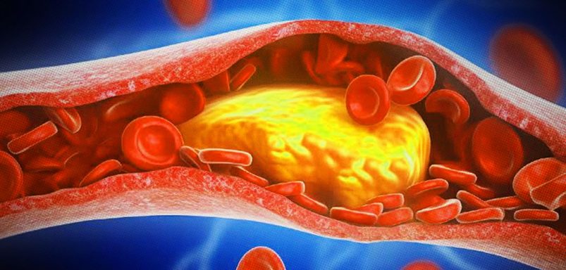 4 foods that raise your cholesterol and harm your heart