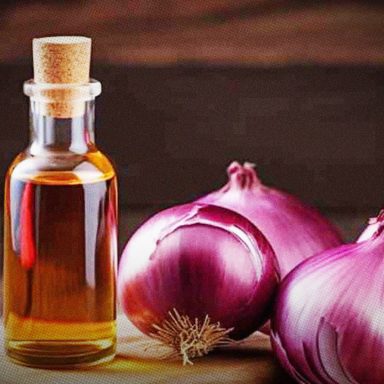 Is onion, methi or black cumin oil really effective in preventing hair loss?