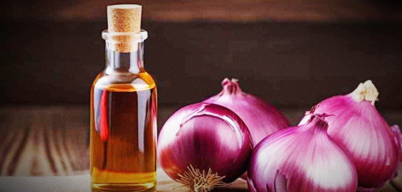 Is onion, methi or black cumin oil really effective in preventing hair loss?