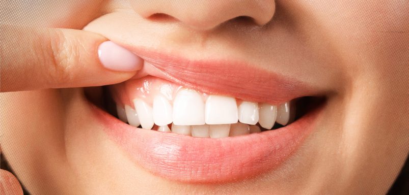 What to eat to protect your mouth's good bacteria