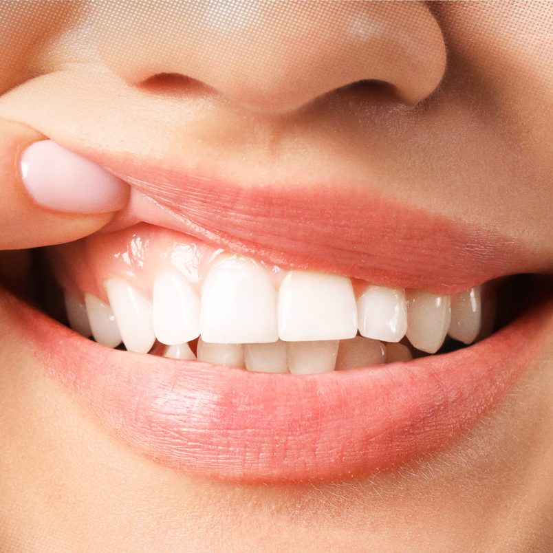 What to eat to protect your mouth's good bacteria