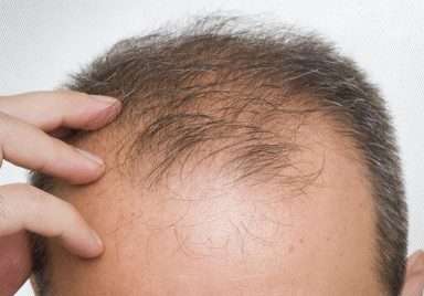 10 interesting facts about hair