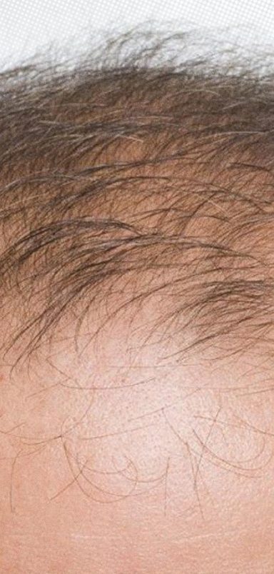 10 interesting facts about hair