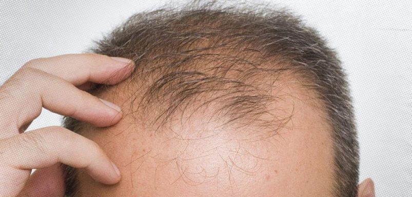10 interesting facts about hair