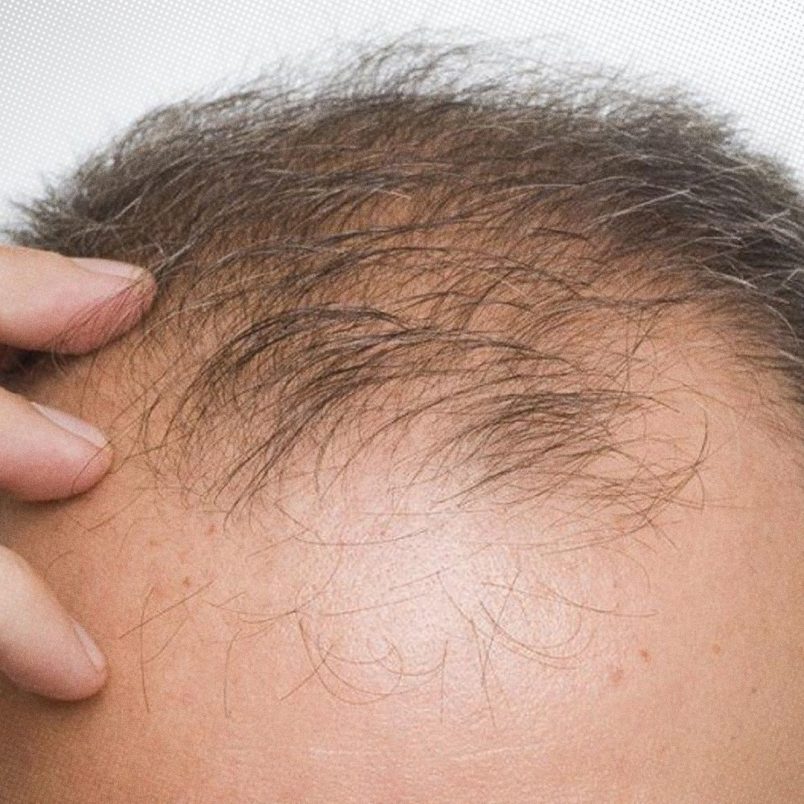 10 interesting facts about hair